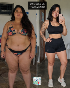 3 ANTES E DEPOIS